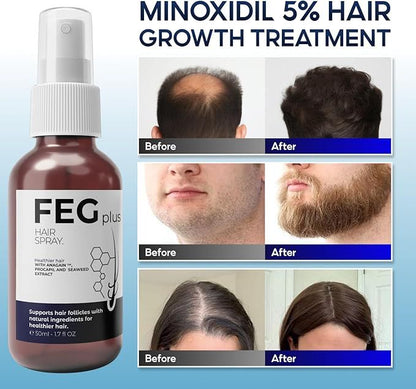 Hair Growth Spray PLUS | Advanced Hair Restoration Formula