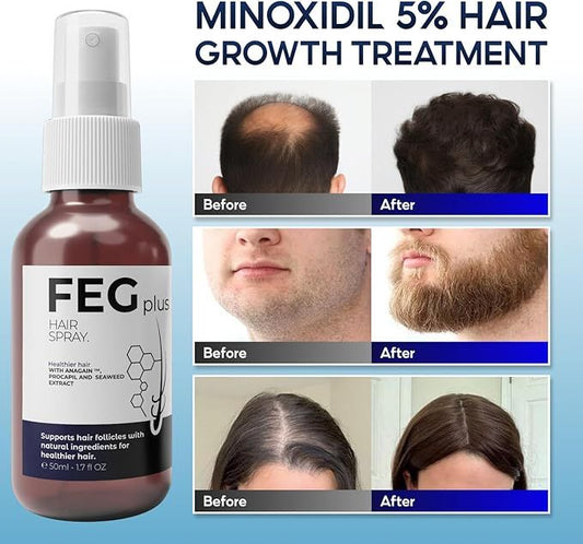 Hair Growth Spray PLUS | Advanced Hair Restoration Formula